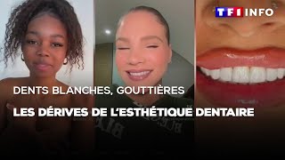 Dents blanches, gouttières : les dérives de l'esthétique dentaire