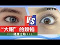眼睛变大未必好 可能是病了 20240601 “大眼”的烦恼 | CCTV科教《健康之路》