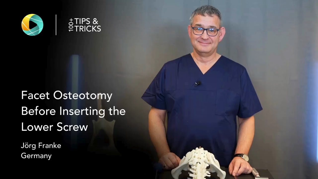 Остеотомия фасеточных суставов перед установкой нижнего винта (Йорг Франке)