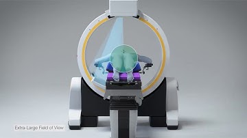 Loop-X Innovación excepcional en la adquisición de imágenes intraoperatorias