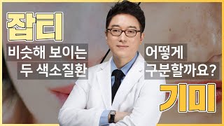 광주기미치료 잡티/기미 뭐가 다른데?