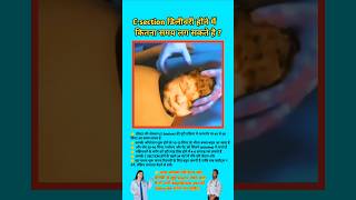 C-section डिलीवरी होने में  कितना समय लग सकते है? c-section delivery time ll#viral #shorts #csection