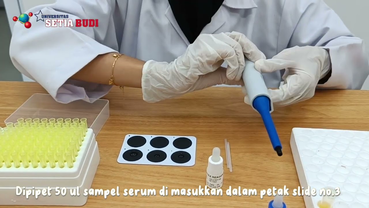 Pemeriksaan C-Reactive Protein (CRP) Secara Kualitatif