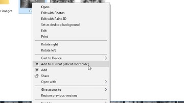 Send files directly to Mediadent