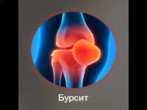 кармолис гель для суставов отзывы цена