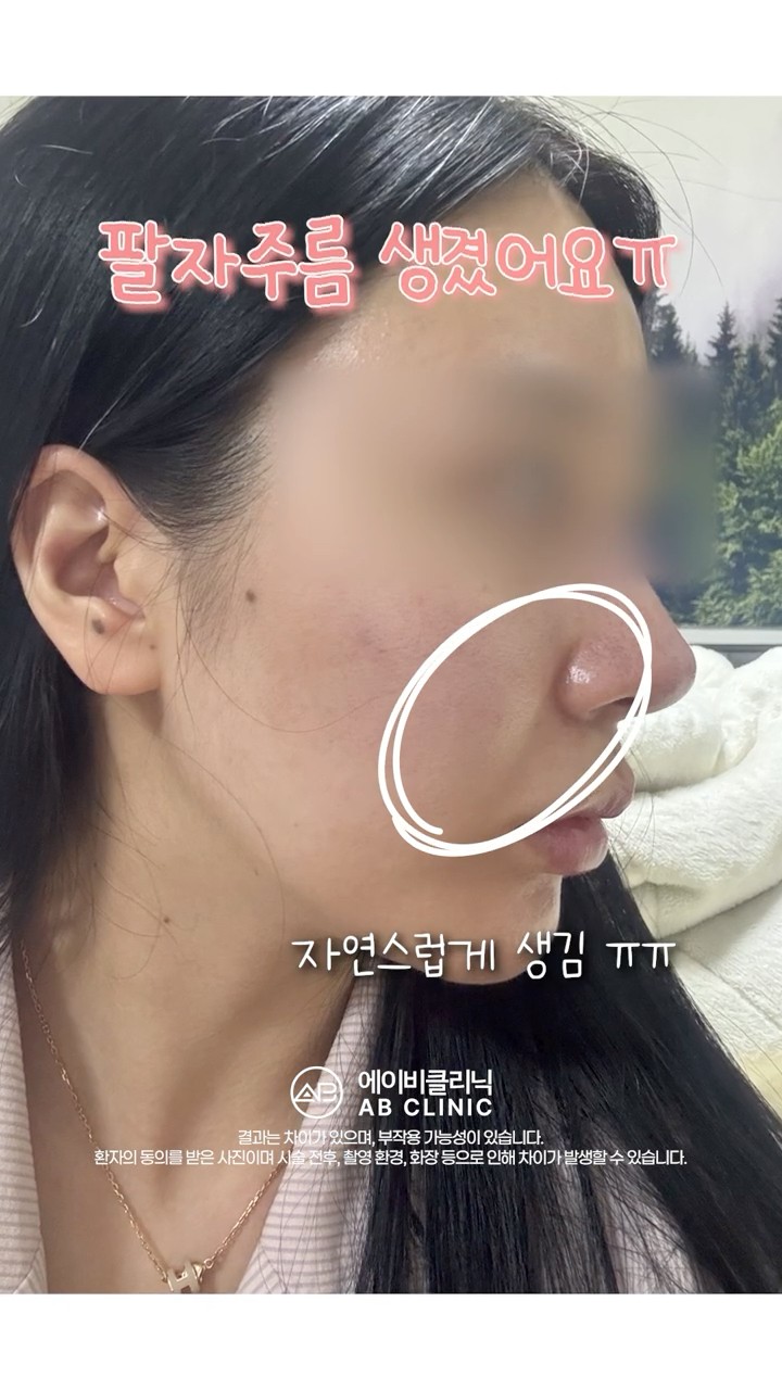 쥬베룩볼륨 후기 낋여옴!