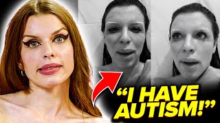 Julia Fox OPENS UP About Autism!