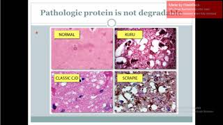 Prion diseases for USMLE step 1 ( in arabic )