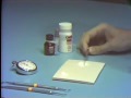 Zinc Oxide-Eugenol: Intermediate Restorative Material