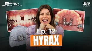 EP.12: Hybrid Hyrax Explained: The Future of Class III Treatment Starts Here