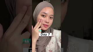 2 Minggu Pake Masker Yoghurt Yang Bisa Di Peel Off
