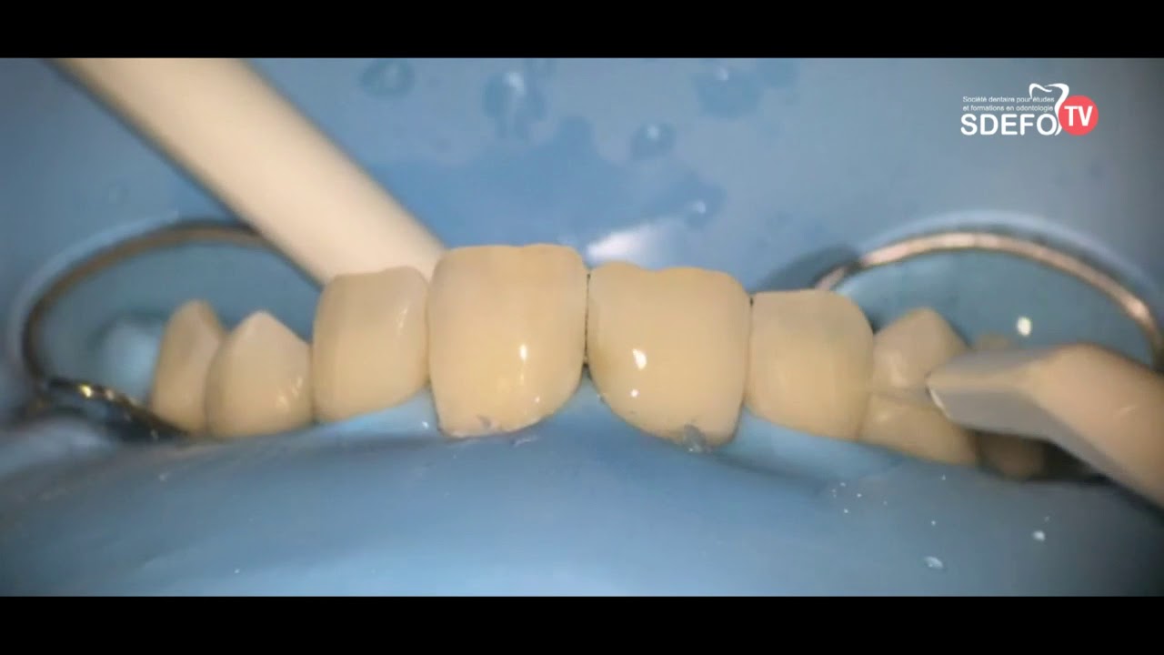 From root to crown,  exclusive advanced courses in microdentistry