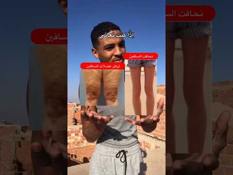 حل مشكلة نحافت الساقين وترهل عضلات الساقين تمارين الارجل في المنزل