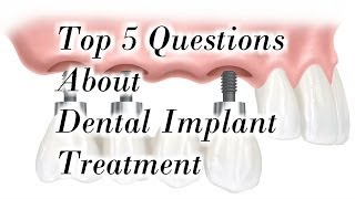 Top 5 Questions about Dental Implant Treatment