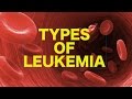 Leukemia || USMLE