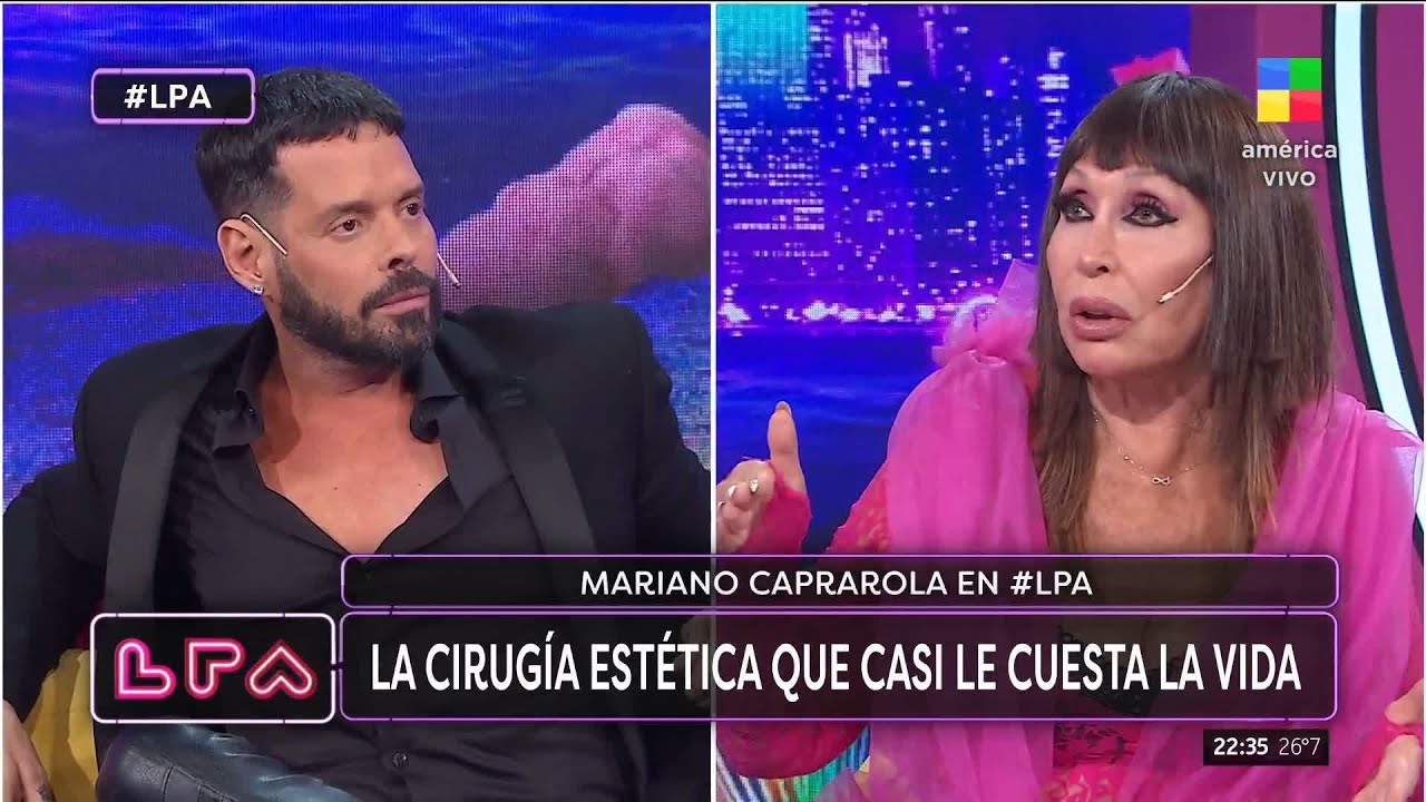 🔴 Mariano Caprarola y la cirugía estética que casi le cuesta la vida
