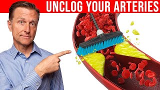 The #1 Best Remedy to Clean Plaque From Your Arteries