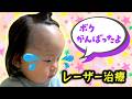 ◆【0歳赤ちゃん】小さな体で頑張りました！みなとくん2回目の太田母斑のレーザー治療◆