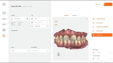 3DISC | Scan&Tell Preleminary Examination