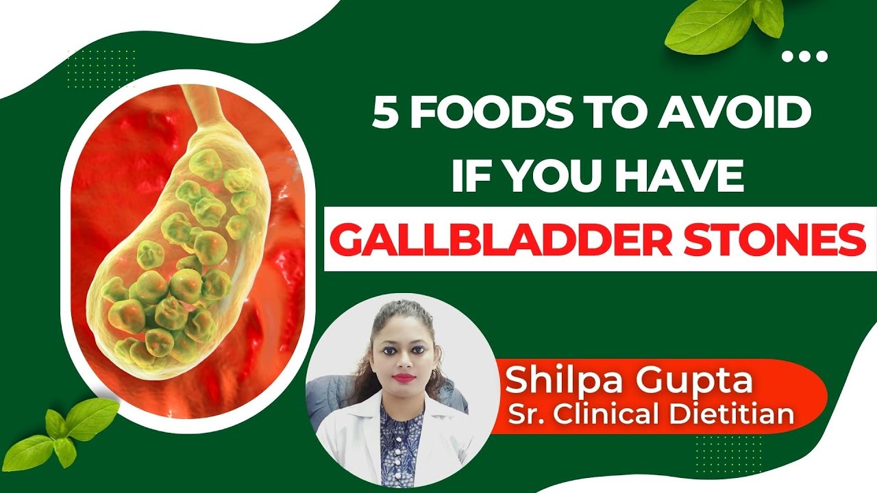 Food To Avoid If You Have Gallbladder Stone 