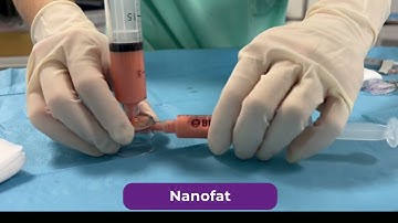 Tulip Nano System - Orthobiologics Quick Start