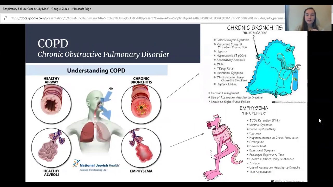 copd with respiratory failure case study