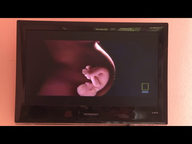 Проблема прерывания беременности