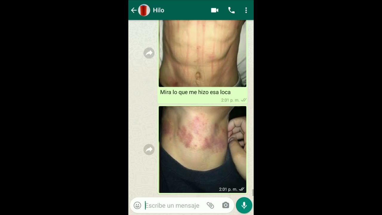 Tu amor me hace daño