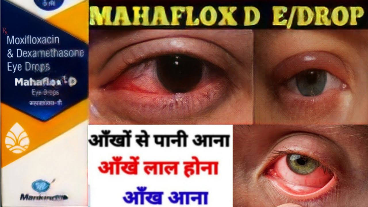 Mahaflox d eye drops in hindi Moxifloxacin and dexamethasone eye