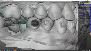 B4D Bracket Remover
