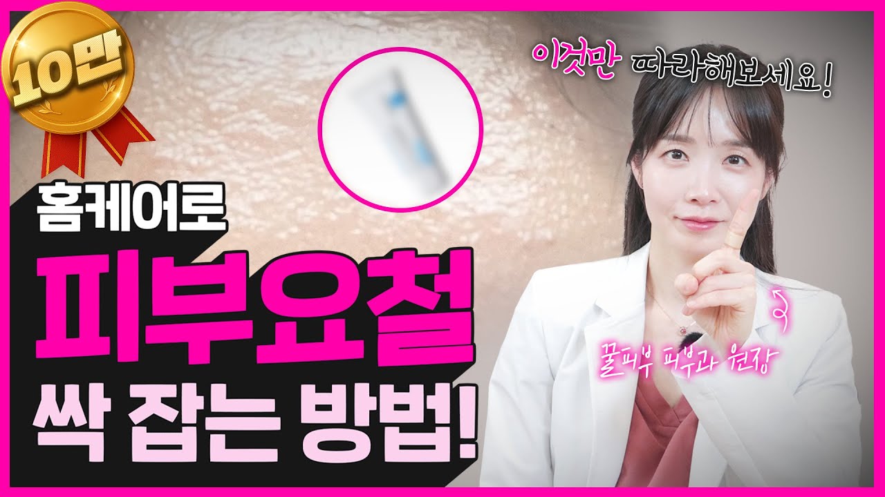 지긋지긋한 요철 없애는 방법?ㅣ의사가 알려주는 요철 홈케어 방법 (좁쌀여드름, 편평사마귀, 비립종) - YouTube