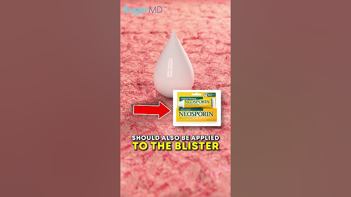 How To Take Care Of BLISTERS ON YOUR SKIN   [Sugarmds.com]