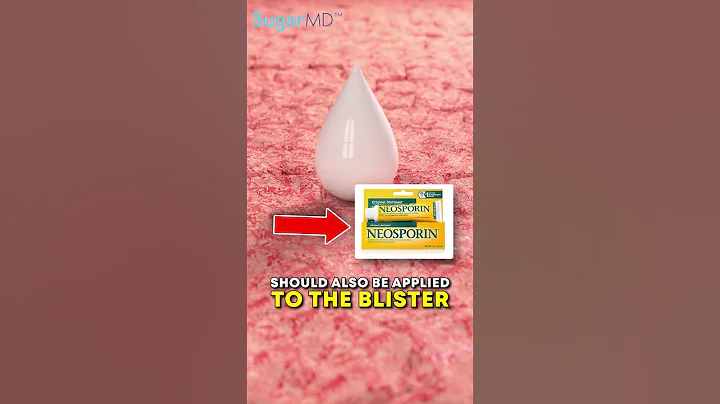 How To Take Care Of BLISTERS ON YOUR SKIN   [Sugarmds.com]