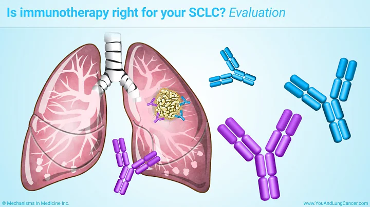 Immunotherapy Treatments for Small Cell Lung Cancer (SCLC) - DayDayNews