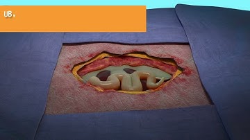 MicroMatrix® Flex Animation