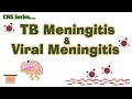 TB Meningitis & Viral Meningitis || CNS infections || CNS Series CH#10