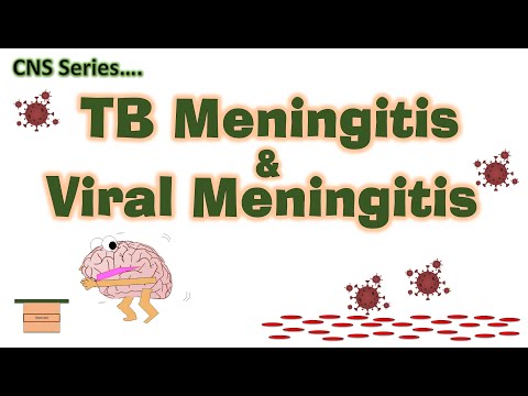 TB Meningitis &