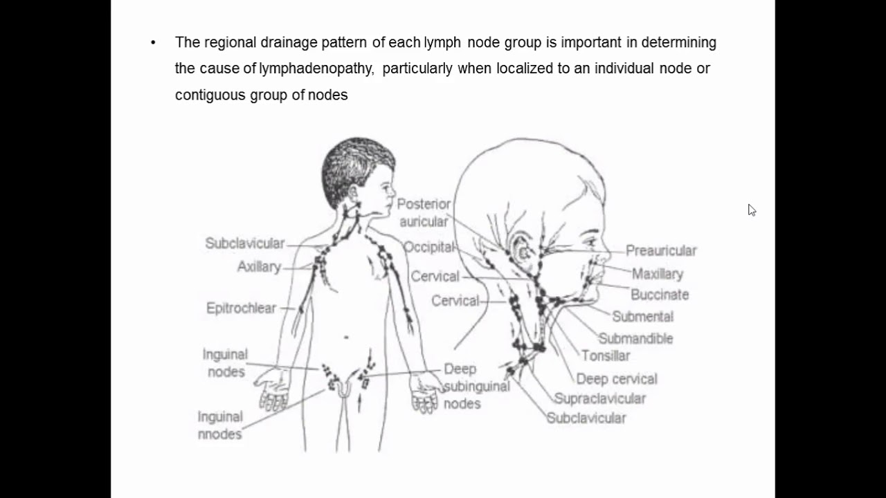 Pediatrics Lymphadenopathy 1372020 Youtube