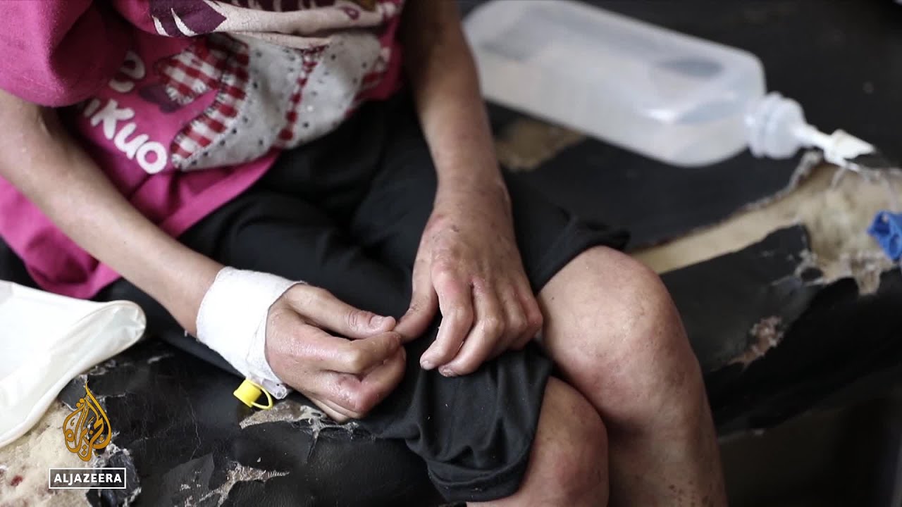 الأمم المتحدة تحذر من انتشار الأمراض في غزة: ارتفاع حالات التهاب الكبد