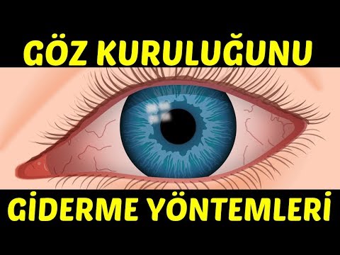 GÖZ KURULUĞUNU GİDERME YÖNTEMLERİ