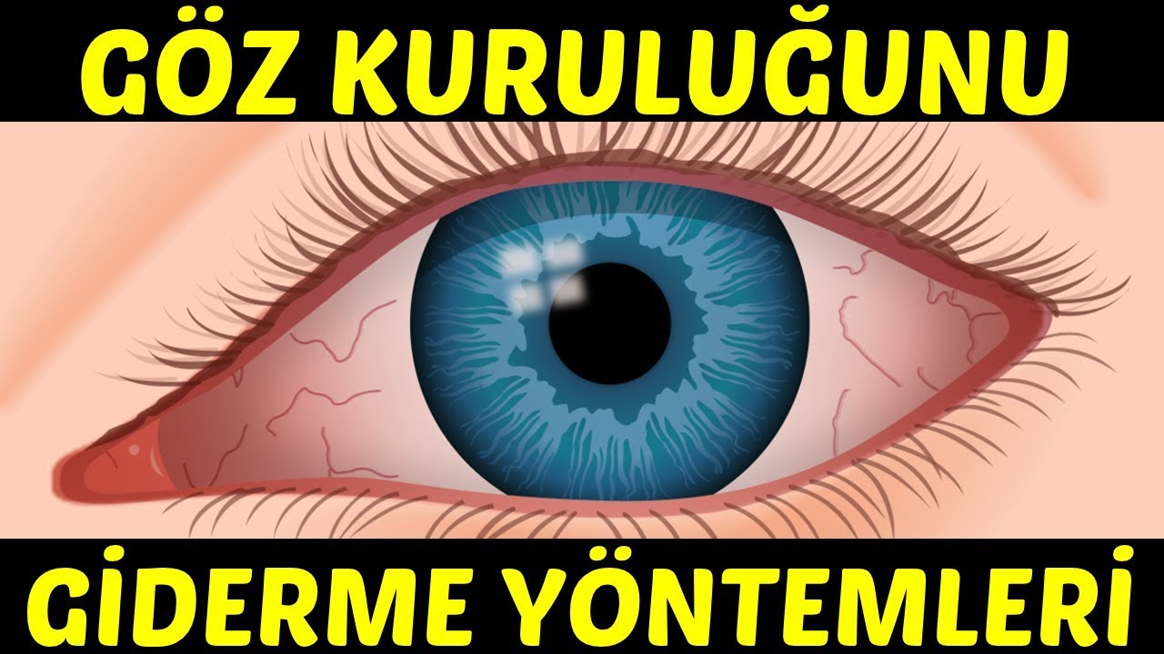 Goz Kurulugunu Giderme Yontemleri Youtube