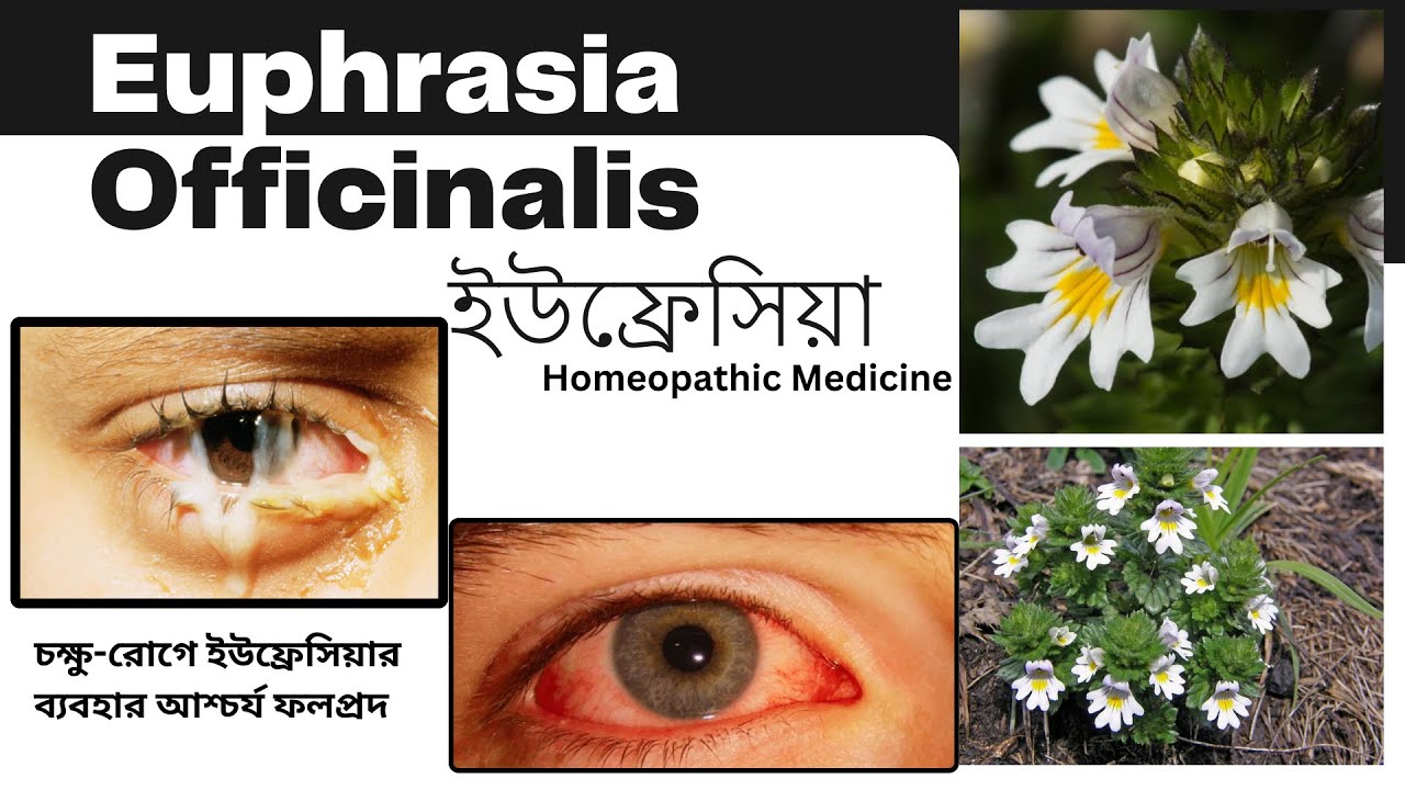 Euphrasia | ইউফ্রেসিয়া | Euphrasia officinalis | Materia Medica | Learn Euphrasia easily