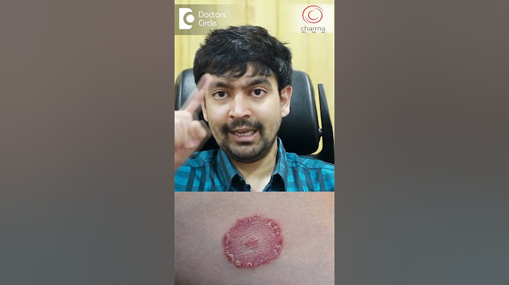 Treatment of Fungal Infection of Private Parts - Dr. Rajdeep Mysore | Doctors' Circle #shorts