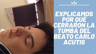 Explicamos por qué Cerraron la Tumba del Beato Carlo Acutis