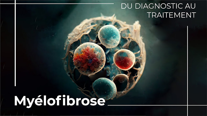 Le cancer de la myélofibrose est-il curable?