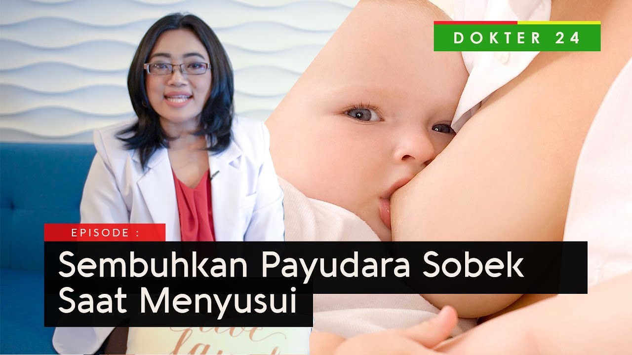 Obat puting susu luka karena gigitan bayi