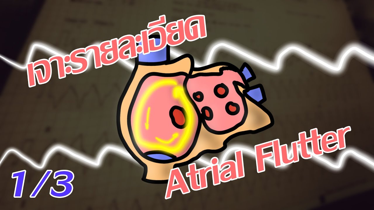 มารู้จัก Atrial Flutter กันเถอะ [Atrial Flutter Part 1/3] | Frontline ...