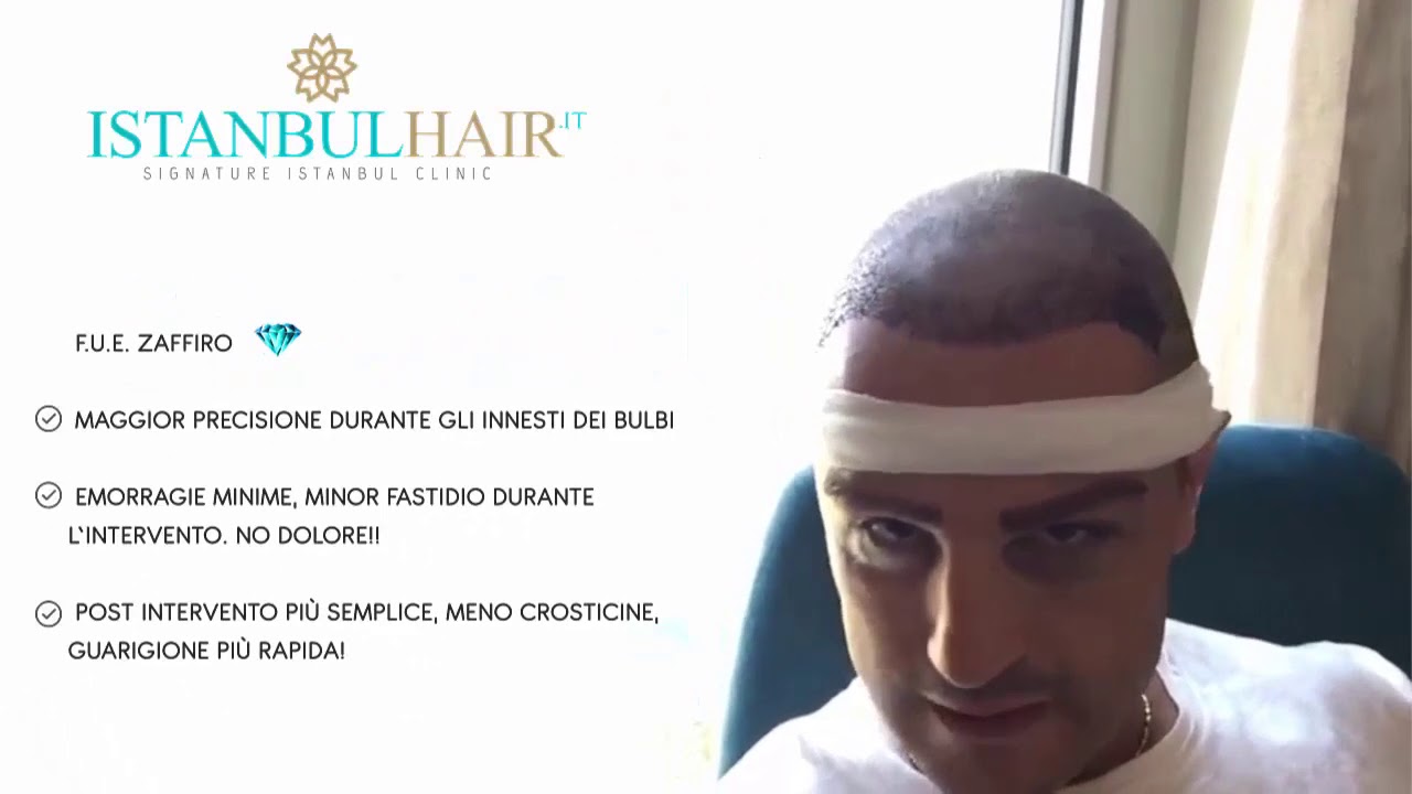 FUE ZAFFIRO ISTANBUL HAIR YouTube