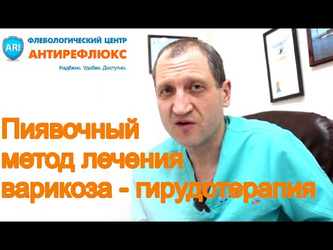 Народные методы лечения варикоза гирудотерапия