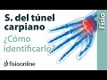 Cómo saber si tienes el síndrome del túnel carpiano